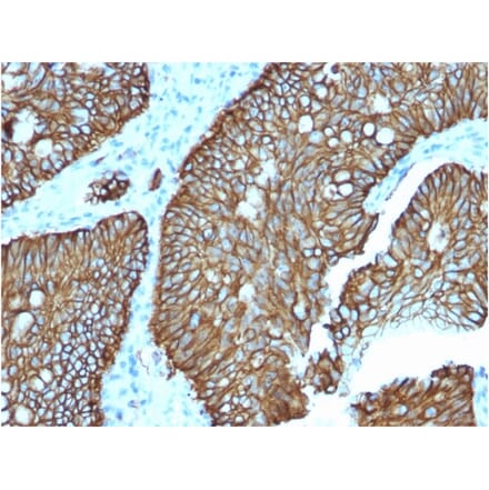 Immunohistochemistry - Anti-LI Cadherin Antibody [CDH17/2618] - BSA and Azide free (A251258) - Antibodies.com