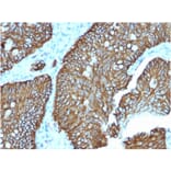Immunohistochemistry - Anti-LI Cadherin Antibody [CDH17/2618] - BSA and Azide free (A251258) - Antibodies.com