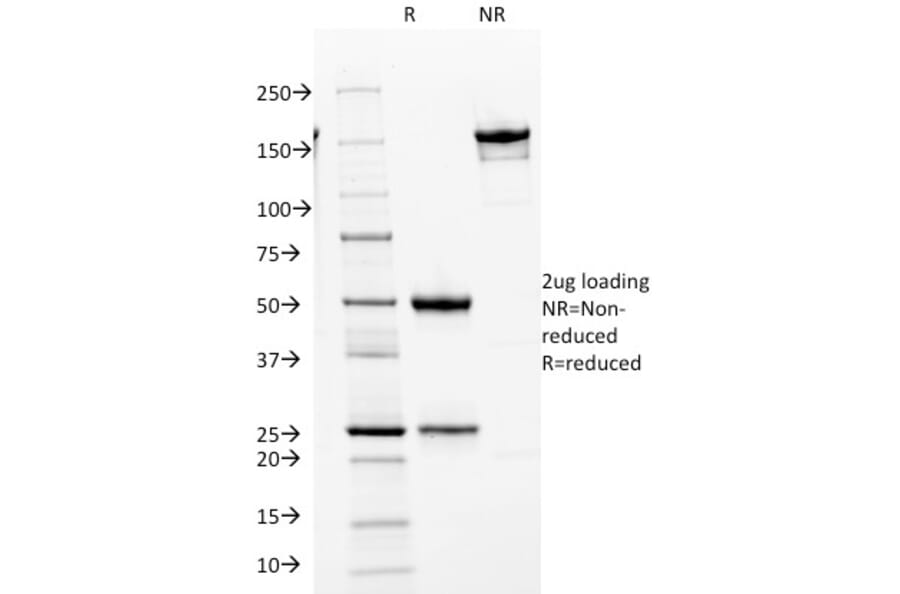 SDS-PAGE - Anti-CDK2 Antibody [AN4.3] - BSA and Azide free (A251258) - Antibodies.com