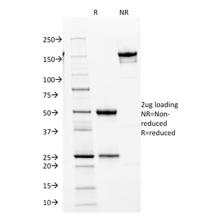 SDS-PAGE - Anti-CDK2 Antibody [AN4.3] - BSA and Azide free (A251258) - Antibodies.com