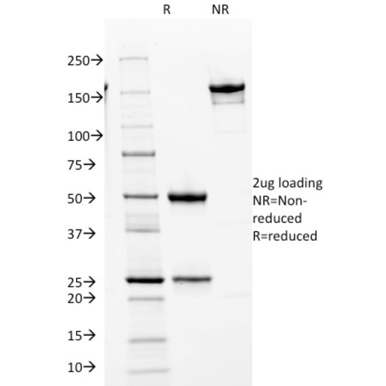 SDS-PAGE - Anti-CDK2 Antibody [AN4.3] - BSA and Azide free (A251258) - Antibodies.com