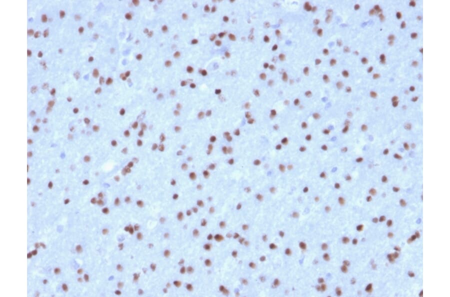 Immunohistochemistry - Anti-OLIG2 Antibody [OLIG2/2400] - BSA and Azide free (A251260) - Antibodies.com