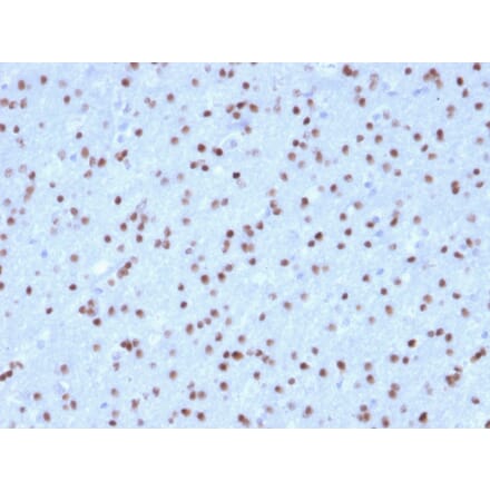Immunohistochemistry - Anti-OLIG2 Antibody [OLIG2/2400] - BSA and Azide free (A251260) - Antibodies.com