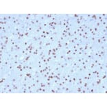 Immunohistochemistry - Anti-OLIG2 Antibody [OLIG2/2400] - BSA and Azide free (A251260) - Antibodies.com