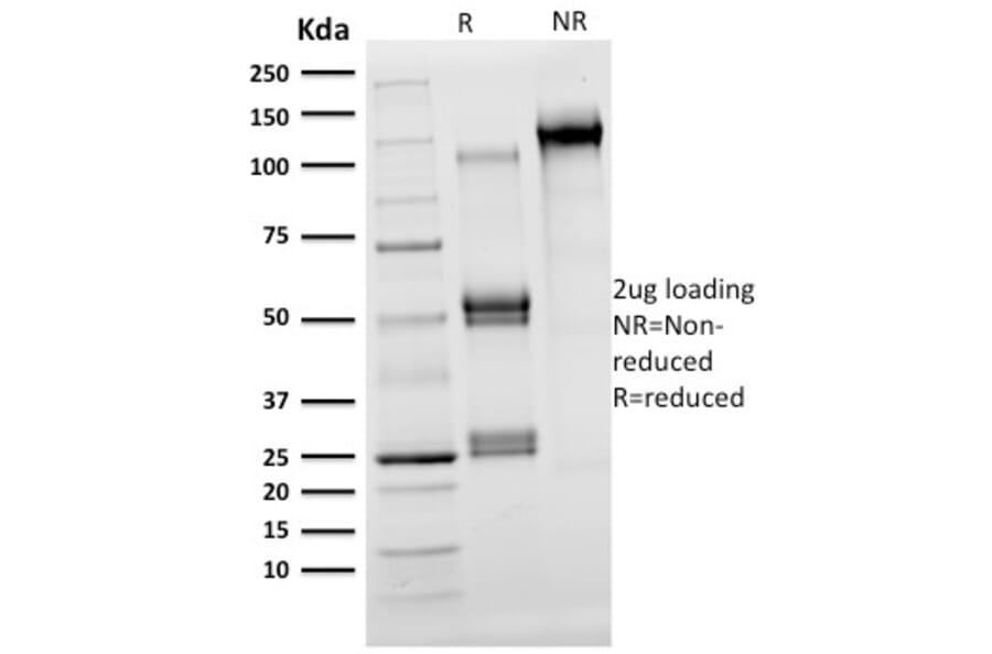 SDS-PAGE - Anti-OLIG2 Antibody [OLIG2/2400] - BSA and Azide free (A251260) - Antibodies.com