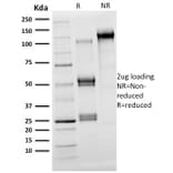 SDS-PAGE - Anti-OLIG2 Antibody [OLIG2/2400] - BSA and Azide free (A251260) - Antibodies.com