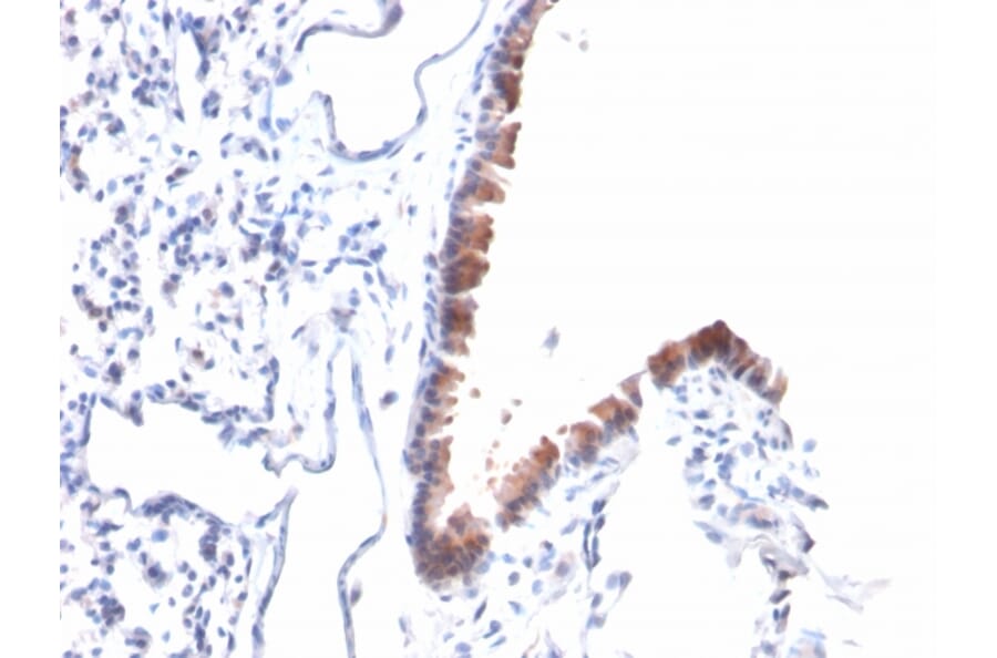 Immunohistochemistry - Anti-Mesothelin Antibody [MSLN/2131] - BSA and Azide free (A251261) - Antibodies.com