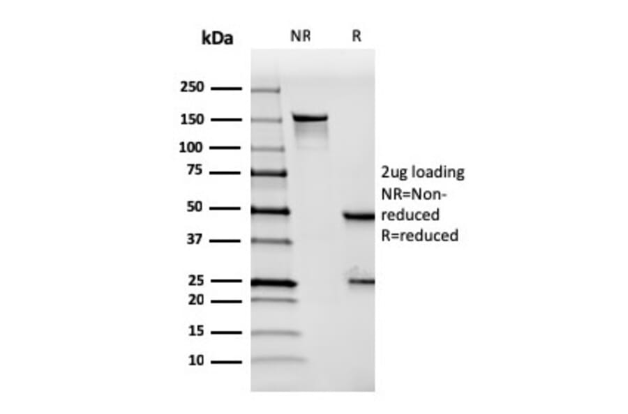 SDS-PAGE - Anti-Mesothelin Antibody [MSLN/3384] - BSA and Azide free (A251263) - Antibodies.com