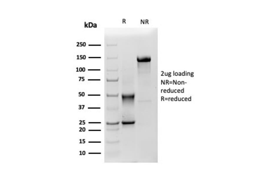 SDS-PAGE - Anti-Mesothelin Antibody [MSLN/3385] - BSA and Azide free (A251264) - Antibodies.com