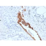 Immunohistochemistry - Anti-Mesothelin Antibody [MSLN/3387] - BSA and Azide free (A251265) - Antibodies.com