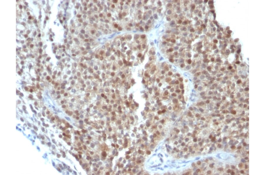 Immunohistochemistry - Anti-p21 Antibody [CIP1/823 + DCS-60.2] - BSA and Azide free (A251270) - Antibodies.com