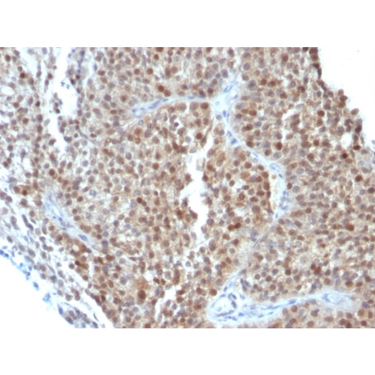 Immunohistochemistry - Anti-p21 Antibody [CIP1/823 + DCS-60.2] - BSA and Azide free (A251270) - Antibodies.com