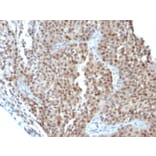 Immunohistochemistry - Anti-p21 Antibody [CIP1/823 + DCS-60.2] - BSA and Azide free (A251270) - Antibodies.com