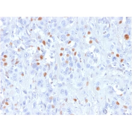 Immunohistochemistry - Anti-p21 Antibody [rCIP1/823] - BSA and Azide free (A251271) - Antibodies.com