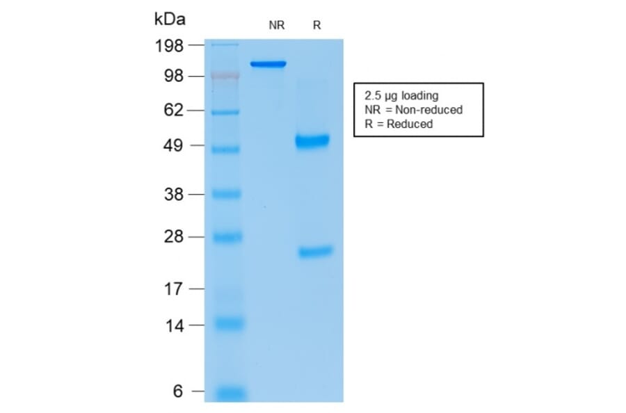 SDS-PAGE - Anti-p21 Antibody [rCIP1/823] - BSA and Azide free (A251272) - Antibodies.com