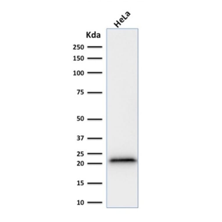 Western Blot - Anti-p21 Antibody [rCIP1/823] - BSA and Azide free (A251272) - Antibodies.com