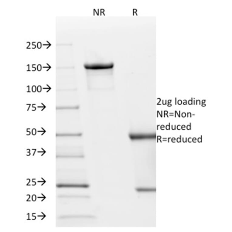 SDS-PAGE - Anti-p21 Antibody [AC8] - BSA and Azide free (A251272) - Antibodies.com