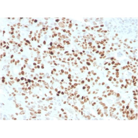 Immunohistochemistry - Anti-p21 Antibody [CIP1/4377R] - BSA and Azide free (A251274) - Antibodies.com
