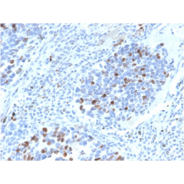 Immunohistochemistry - Anti-p21 Antibody [CIP1/4377R] - BSA and Azide free (A251274) - Antibodies.com