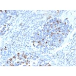 Immunohistochemistry - Anti-p21 Antibody [CIP1/4377R] - BSA and Azide free (A251274) - Antibodies.com