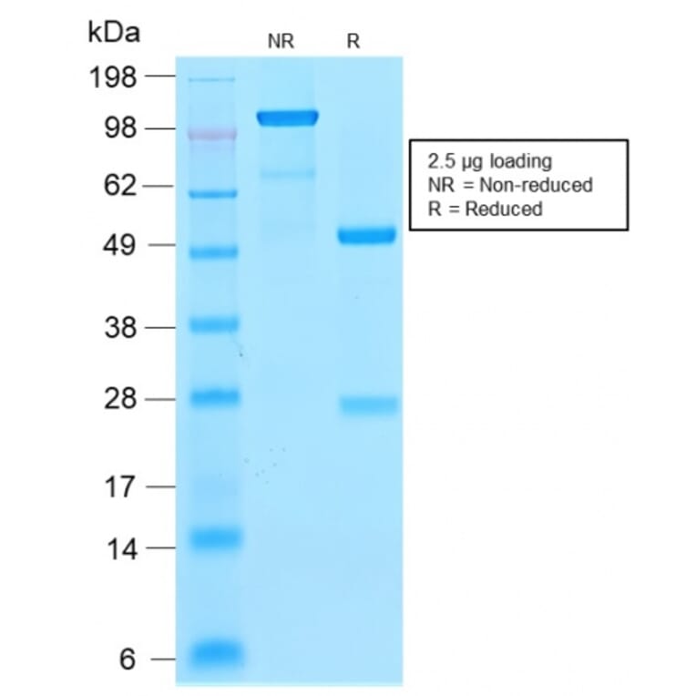 SDS-PAGE - Anti-p21 Antibody [CIP1/2275R] - BSA and Azide free (A251275) - Antibodies.com