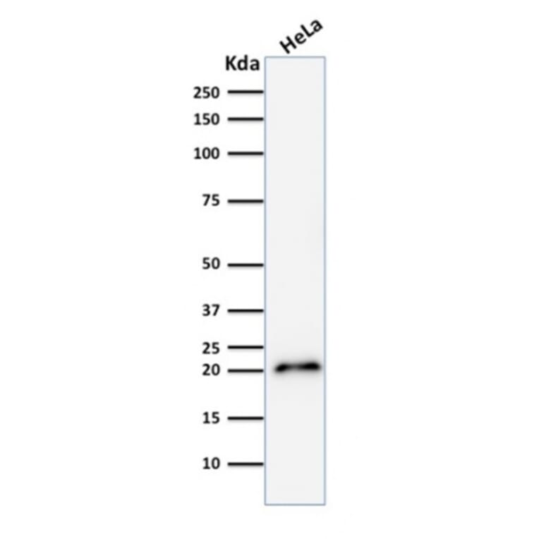 Western Blot - Anti-p21 Antibody [CIP1/2275R] - BSA and Azide free (A251275) - Antibodies.com