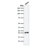 Western Blot - Anti-p21 Antibody [CIP1/2275R] - BSA and Azide free (A251275) - Antibodies.com