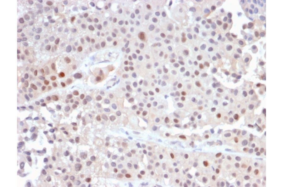 Immunohistochemistry - Anti-p21 Antibody [CIP1/2489R] - BSA and Azide free (A251275) - Antibodies.com