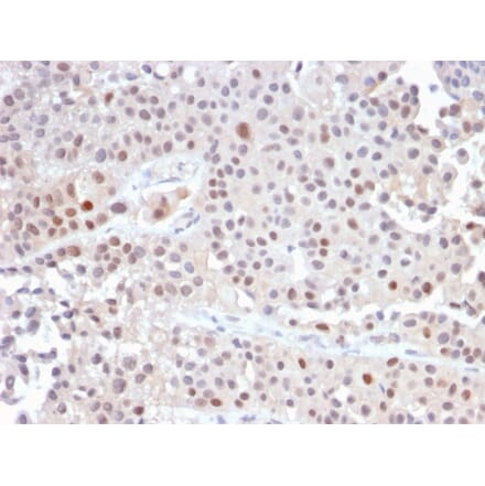Immunohistochemistry - Anti-p21 Antibody [CIP1/2489R] - BSA and Azide free (A251275) - Antibodies.com