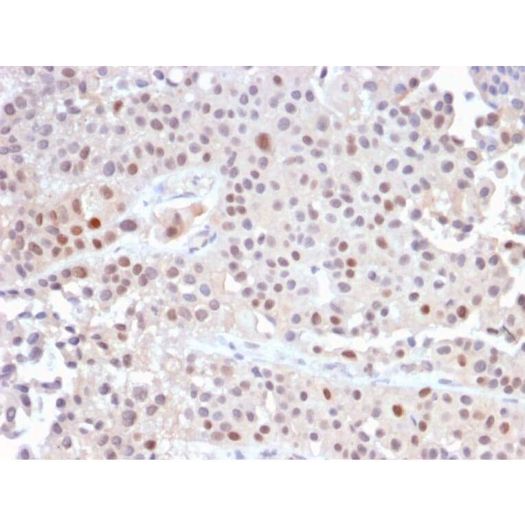 Immunohistochemistry - Anti-p21 Antibody [CIP1/2489R] - BSA and Azide free (A251275) - Antibodies.com