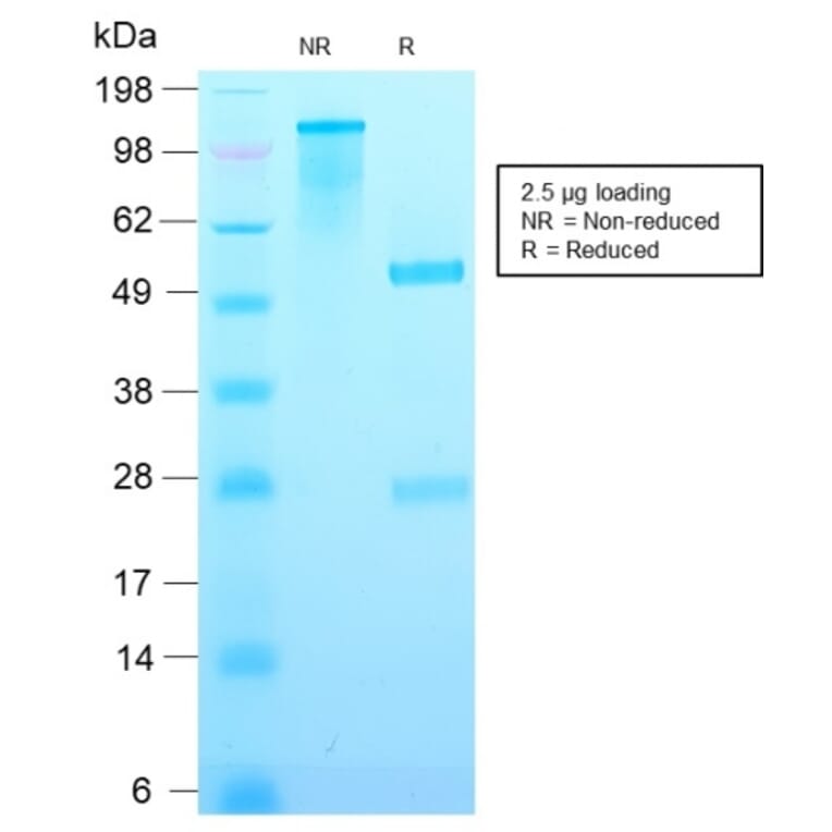 SDS-PAGE - Anti-p21 Antibody [CIP1/2489R] - BSA and Azide free (A251276) - Antibodies.com