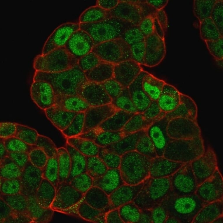 Immunofluorescence - Anti-p27 KIP 1 Antibody [SPM348] - BSA and Azide free (A251277) - Antibodies.com