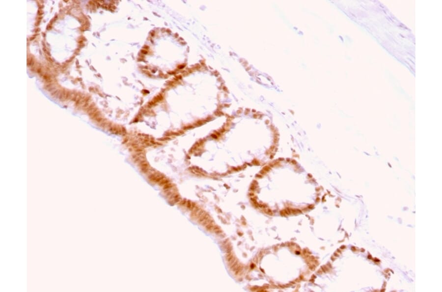 Immunohistochemistry - Anti-p27 KIP 1 Antibody [KIP1/769] - BSA and Azide free (A251279) - Antibodies.com