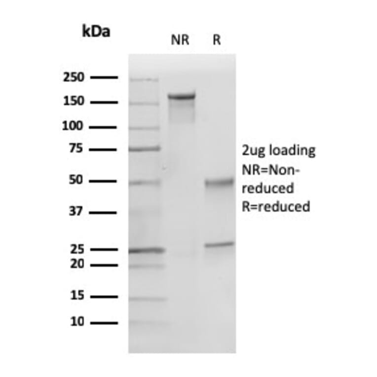 SDS-PAGE - Anti-p27 KIP 1 Antibody [KIP1/769] - BSA and Azide free (A251279) - Antibodies.com