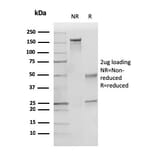SDS-PAGE - Anti-p27 KIP 1 Antibody [KIP1/769] - BSA and Azide free (A251279) - Antibodies.com