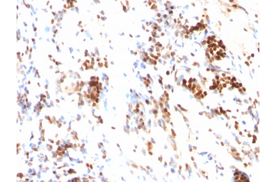 Immunohistochemistry - Anti-p27 KIP 1 Antibody [DCS-72.F6] - BSA and Azide free (A251280) - Antibodies.com