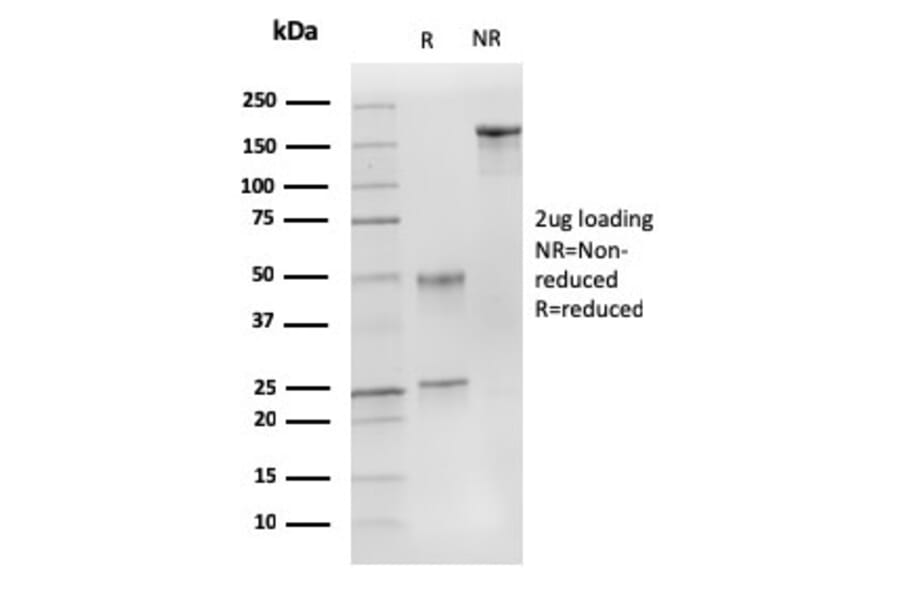 SDS-PAGE - Anti-p27 KIP 1 Antibody [DCS-72.F6] - BSA and Azide free (A251280) - Antibodies.com