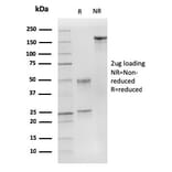 SDS-PAGE - Anti-p27 KIP 1 Antibody [DCS-72.F6 + KIP1/769] - BSA and Azide free (A251281) - Antibodies.com