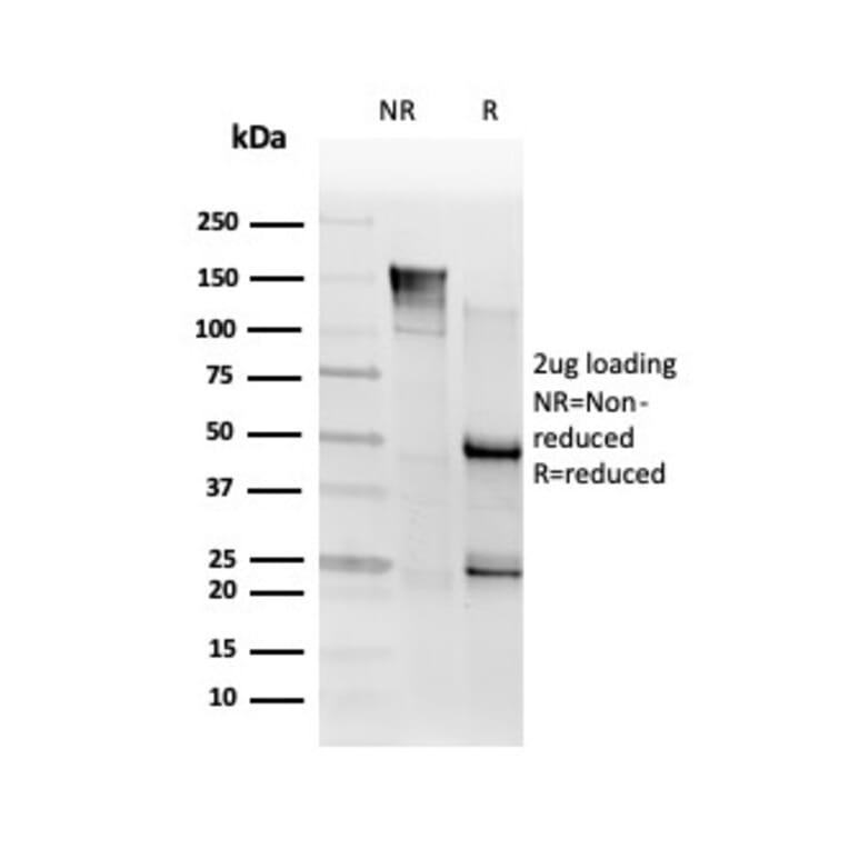 SDS-PAGE - Anti-SMNDC1 Antibody [PCRP-SMNDC1-1A9] - BSA and Azide free (A251282) - Antibodies.com