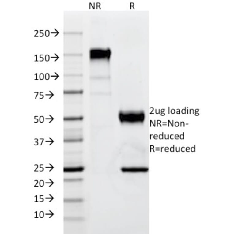 SDS-PAGE - Anti-p57 Kip2 Antibody [SPM308] - BSA and Azide free (A251284) - Antibodies.com