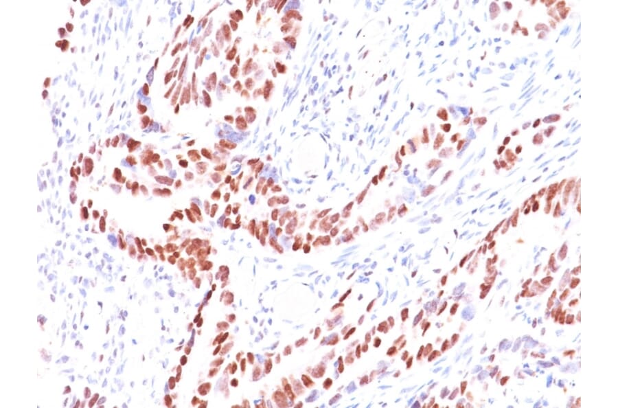 Immunohistochemistry - Anti-p57 Kip2 Antibody [KIP2/880] - BSA and Azide free (A251284) - Antibodies.com