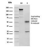 SDS-PAGE - Anti-p57 Kip2 Antibody [KIP2/880] - BSA and Azide free (A251285) - Antibodies.com