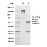 SDS-PAGE - Anti-p57 Kip2 Antibody [57P06] - BSA and Azide free (A251286) - Antibodies.com