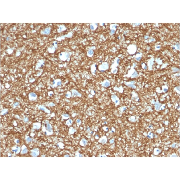 Immunohistochemistry - Anti-p14ARF Antibody [4C6/4] - BSA and Azide free (A251286) - Antibodies.com
