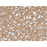 Immunohistochemistry - Anti-p14ARF Antibody [4C6/4] - BSA and Azide free (A251286) - Antibodies.com