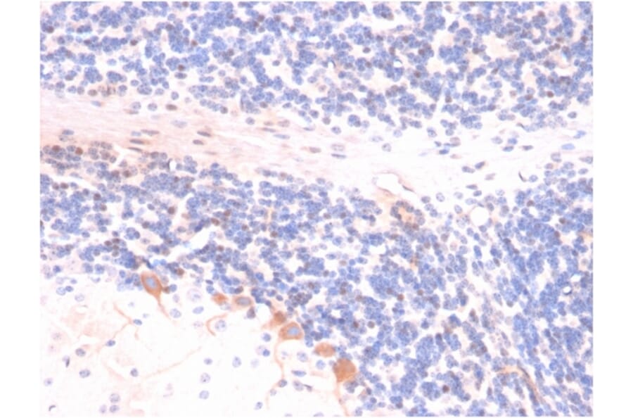 Immunohistochemistry - Anti-p14ARF Antibody [4C6/4] - BSA and Azide free (A251287) - Antibodies.com