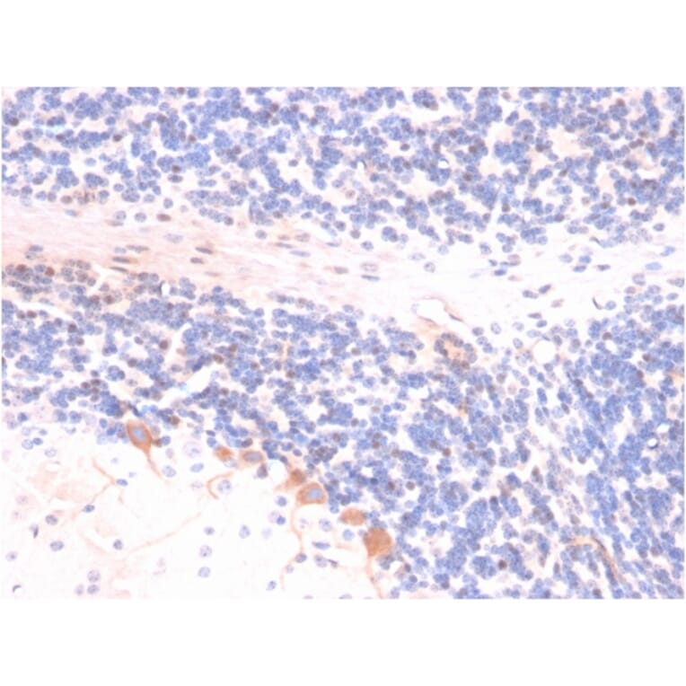 Immunohistochemistry - Anti-p14ARF Antibody [4C6/4] - BSA and Azide free (A251287) - Antibodies.com