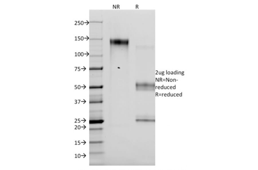 SDS-PAGE - Anti-p14ARF Antibody [4C6/4] - BSA and Azide free (A251287) - Antibodies.com