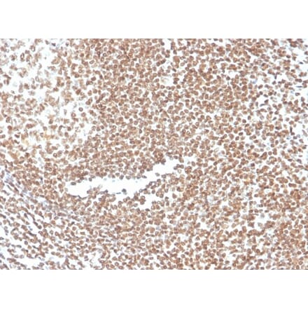 Immunohistochemistry - Anti-p16INK4a Antibody [CDKN2A/3830] - BSA and Azide free (A251288) - Antibodies.com