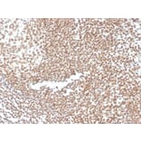 Immunohistochemistry - Anti-p16INK4a Antibody [CDKN2A/3830] - BSA and Azide free (A251288) - Antibodies.com